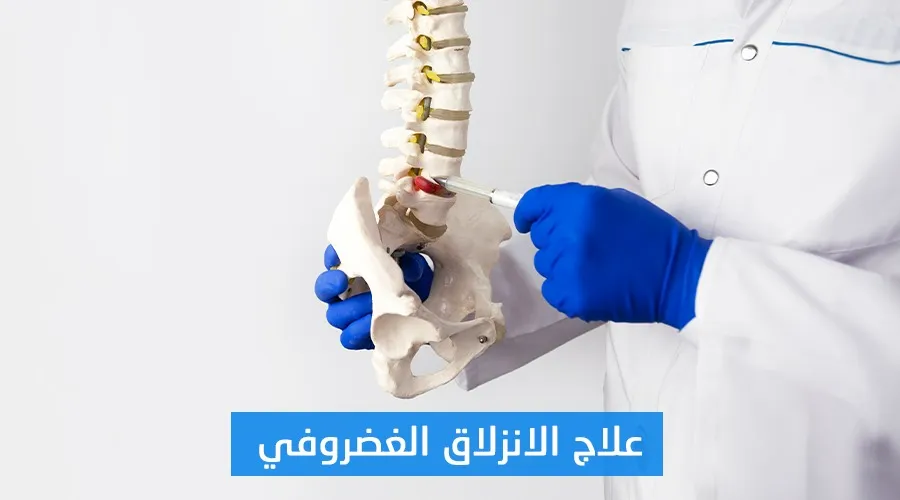 علاج الانزلاق الغضروفي