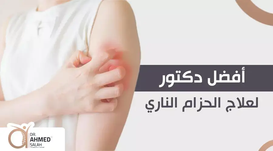 أفضل دكتور لعلاج الحزام الناري