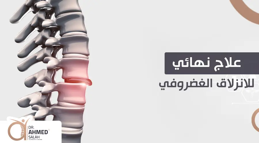 علاج سريع للانزلاق الغضروفي ونهائي