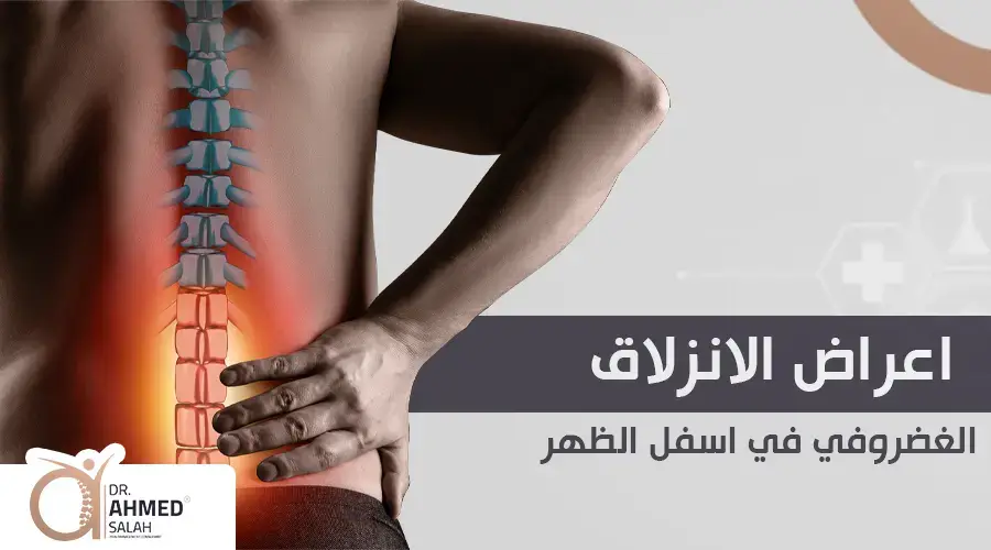 أعراض الانزلاق الغضروفي في أسفل الظهر