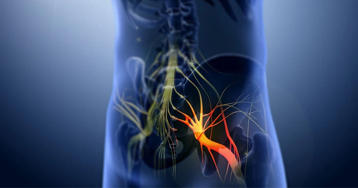 سعر علاج عرق النسا بالتردد الحراري