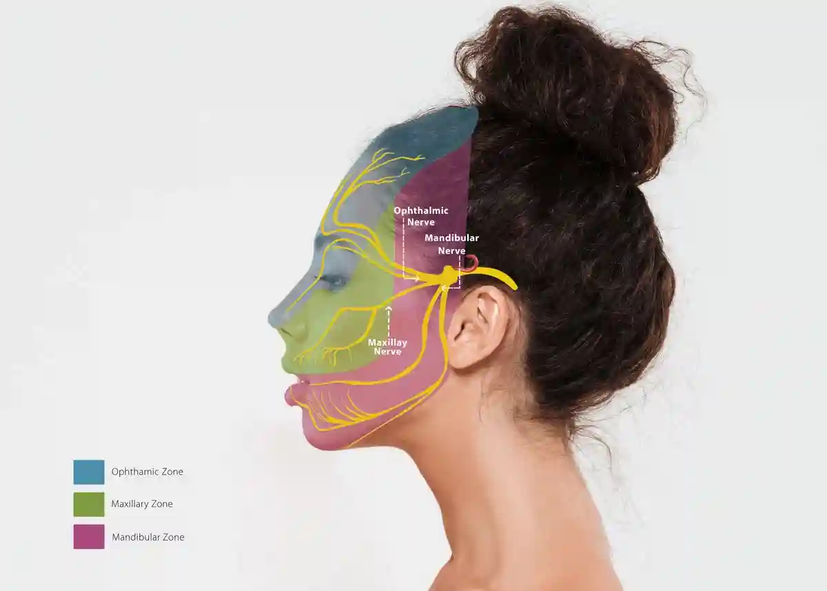 التهاب العصب الخامس التهاب العصب الخامس