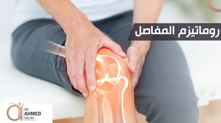 روماتيزم المفاصل